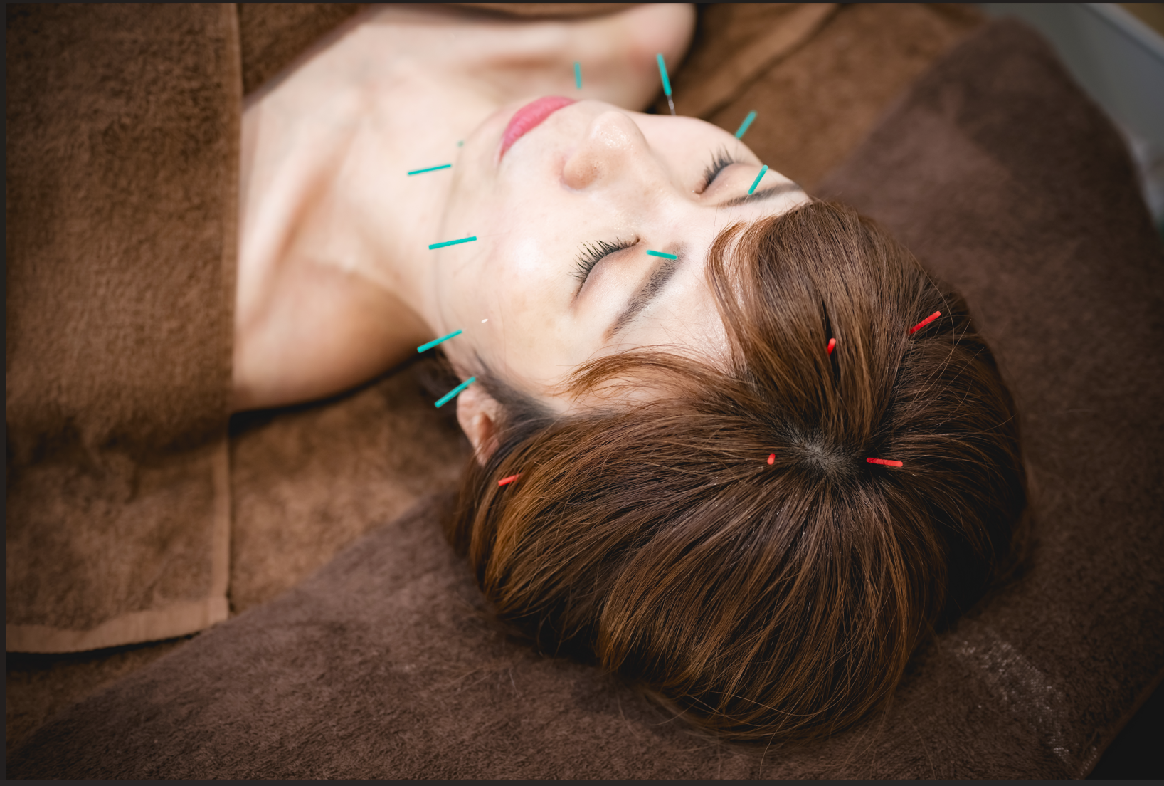 美容鍼灸サロンブルースター料金について